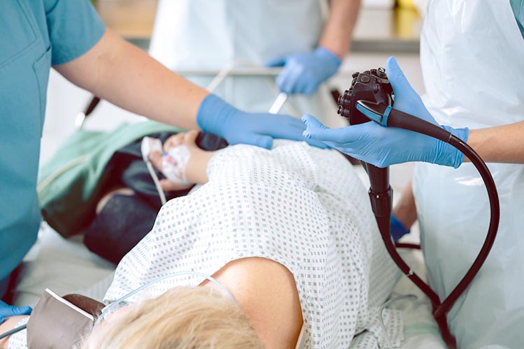 大腸カメライメージ画像