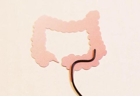 大腸カメラ検査イメージ画像