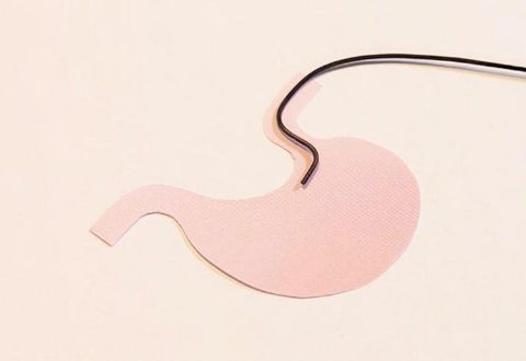 胃カメラ検査イメージ画像